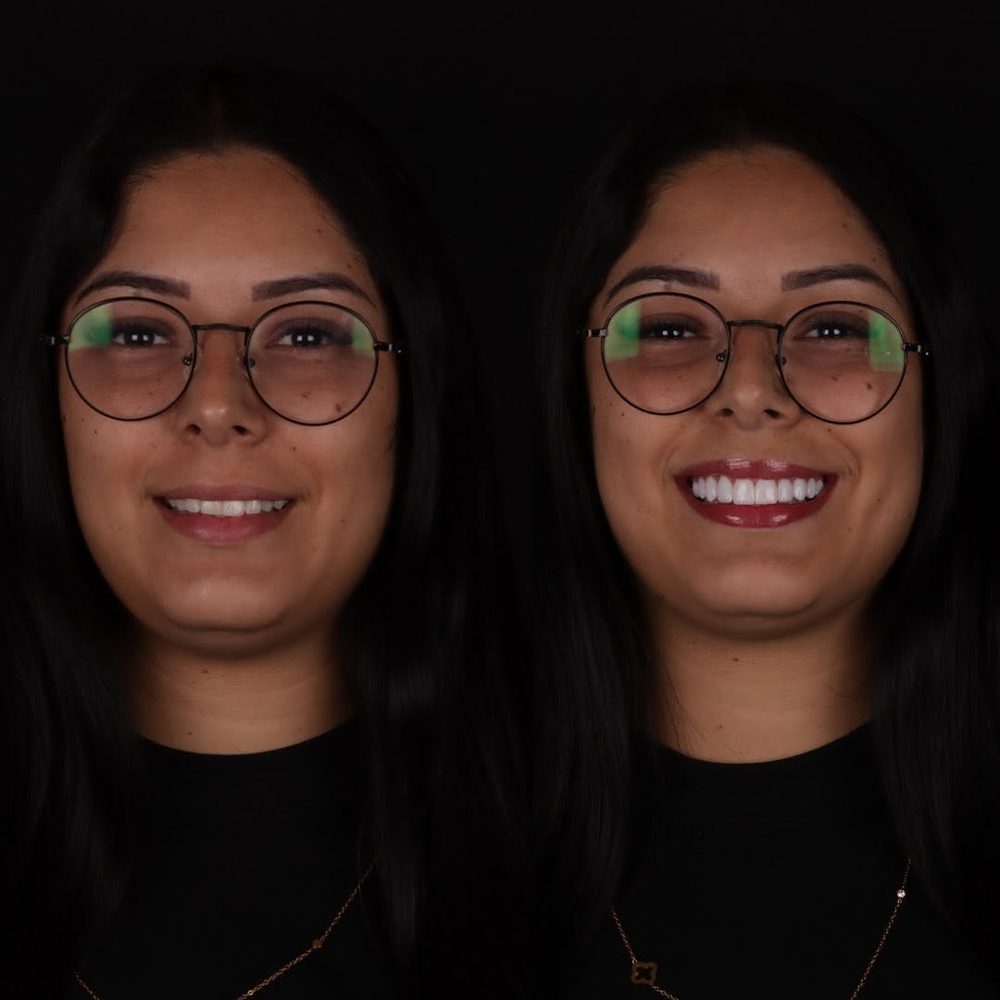 Antes e depois de paciente da Royale