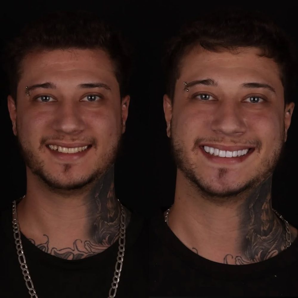 Antes e depois de paciente da Royale