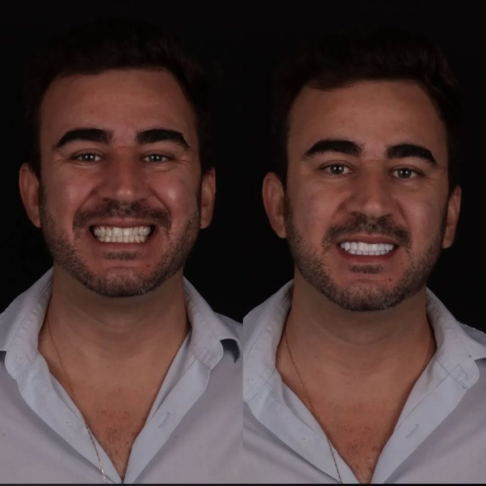 Antes e depois de paciente da Royale