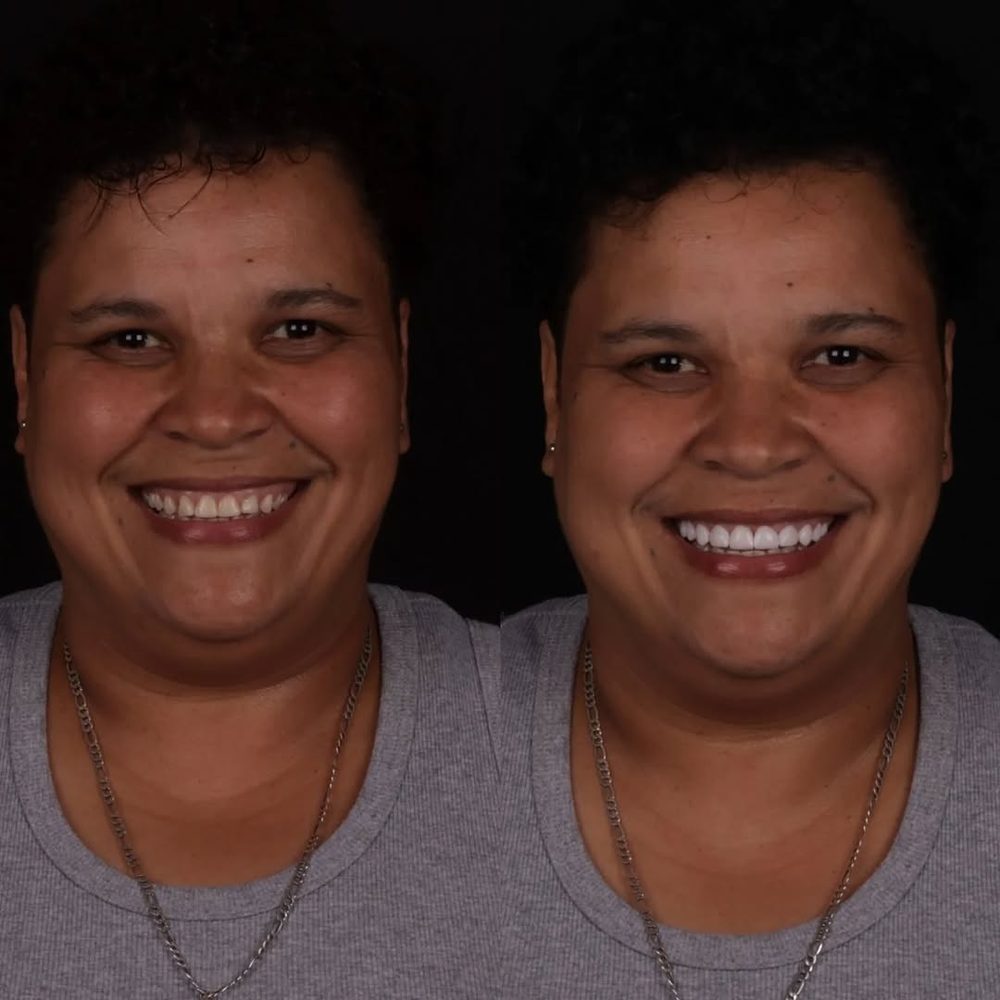 Antes e depois de paciente da Royale